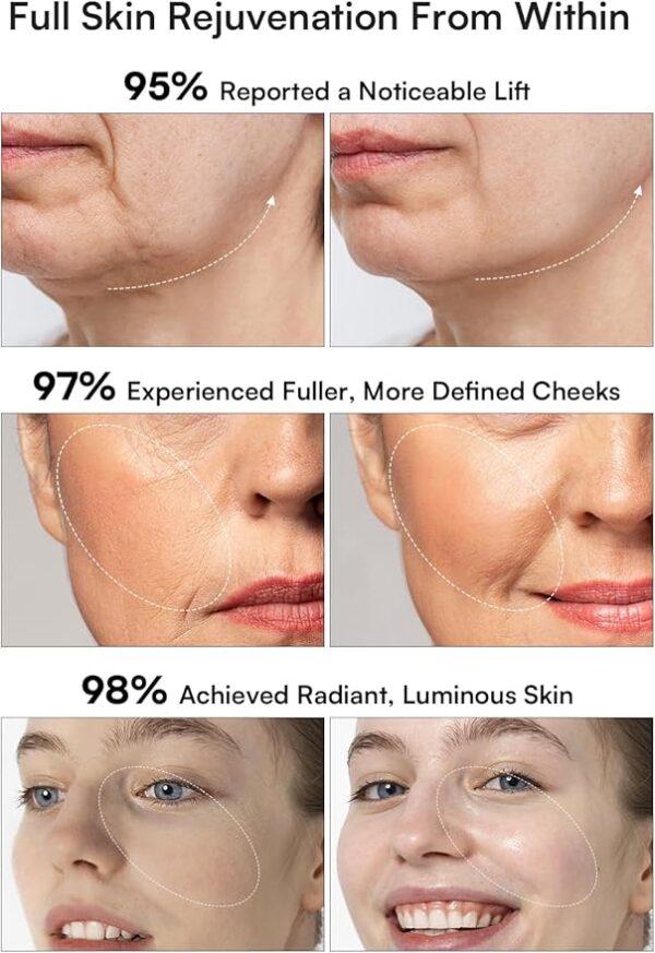 Microcurrent Facial Device, 3-in-1 Facial Massager - Image 3