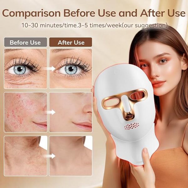 Red Light Therapy Mask for Face,Cordless LED Face Mask Light Therapy, - Image 3