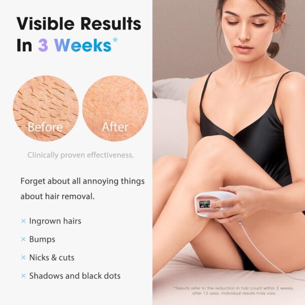 IPL Laser Hair Removal Device for Women & Men - Home 45°F Ice-Cooling Contact for Painless & Long-Lasting Results, - Image 3