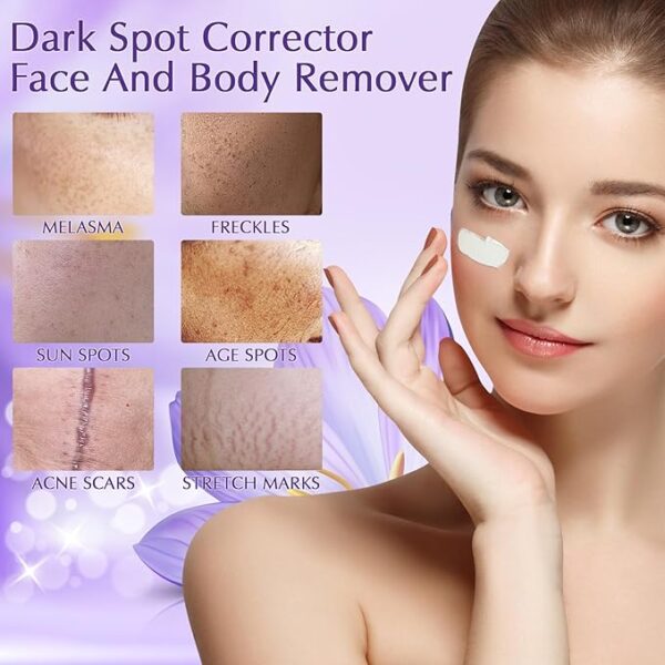 Dark Spot Remover for Face Cream, Dark Spot Corrector, Rapid Tone Repair Retinol Serum for Sun Spots, Age Spots, Skin Brown - Image 2