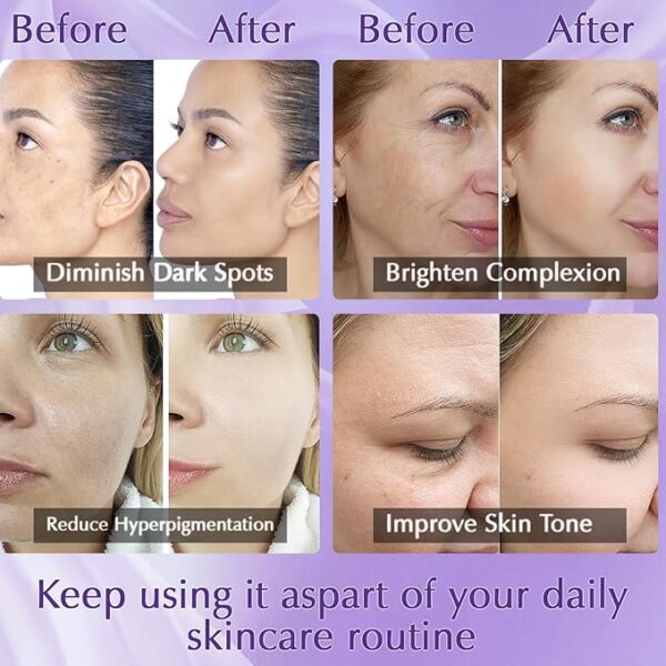 Dark Spot Remover for Face Cream, Dark Spot Corrector, Rapid Tone Repair Retinol Serum for Sun Spots, Age Spots, Skin Brown - Image 3
